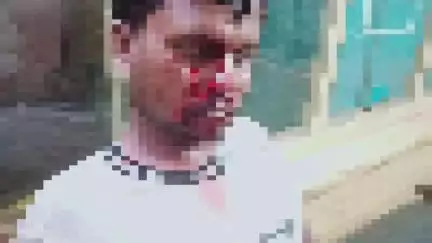 গড়বেতা ৩: মোটর বাইকের ধাক্কায় গুরুতর আহত পথচারী চন্দ্রকোনা রোডে সাত বাঁকুড়া এলাকার ঘটনা