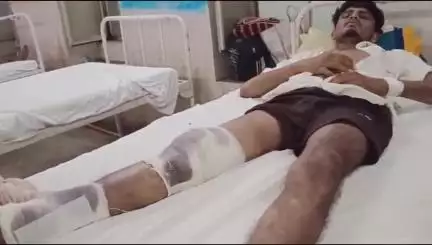 छोटी सरवन: दानपुर कस्बे में ऑटो ने बाइक को चपेट में लिया, युवक को पैर पर लगी चोट, एमजी अस्पताल में उपचार जारी