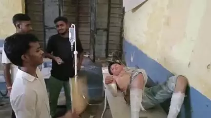 दुधि: रामलीला मैदान के पास मोमोज बनाते समय एक युवक पर गर्म तेल गिरा, युवक हुआ घायल