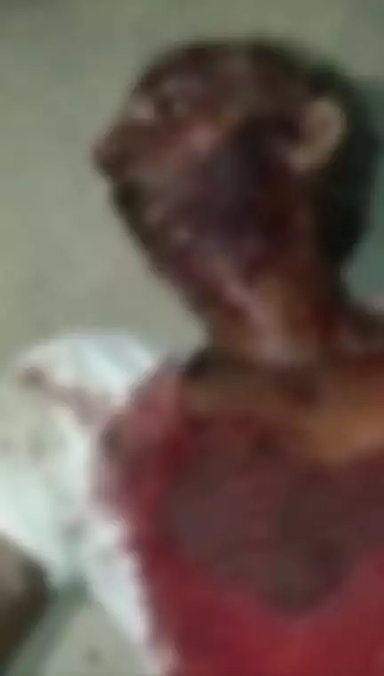 बिहार के बेतिया में भरी पंचायत में मर्डर, ज़मीन विवाद में बेटे ने पिता को चाकू से गोद-गोदकर मार डाला