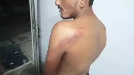 जबलपुर: अज्ञात बदमाशों ने लूट की वारदात को अंजाम दिया, युवक के साथ की मारपीट