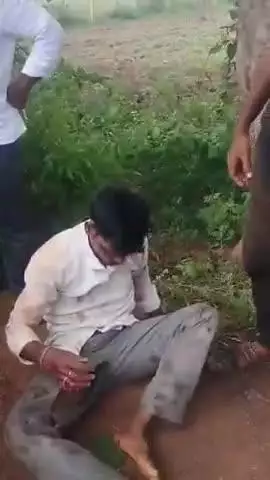 జహీరాబాద్: మద్రి సమీపంలో బైక్ పై నుండి తప్పి కింద పడ్డ వ్యక్తి ,తీవ్ర గాయాలు