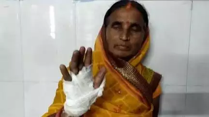 ताजपुर: कोठिया डुमरी गांव में ताड़ के पेड़ से फल्ली तोड़ने के विवाद में महिला से मारपीट