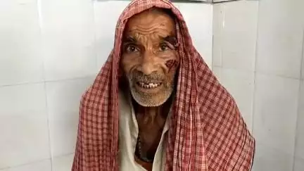 पूसा: माली नगर ठहरा गांव में कुत्ते ने एक बुजुर्ग व्यक्ति को काटा, पूसा अस्पताल में कराया गया भर्ती