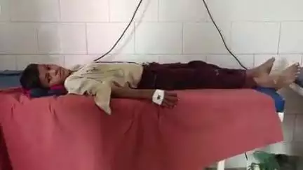 खलीलाबाद: गांव के बगीचे में आम की तलाश में गए 10 वर्षीय बालक को जहरीले सर्प ने काटा, जिला अस्पताल में इलाज जारी
