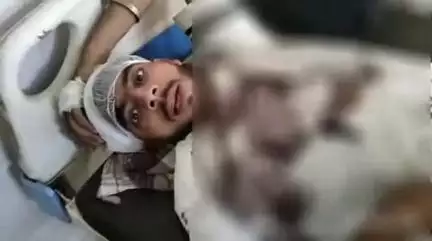 बिजनौर: गांव पीर उमरी में गाली-गलौज को लेकर दबंगों ने एक युवक को मारपीट कर किया घायल