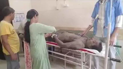 औराई: औराई के अर्जुन पट्टी में ट्रांसफार्मर पर गिरे हाइटेंशन तार से दौरा हाई वोल्टेज करंट, चार लोग झुलसे