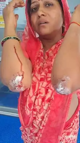 बीकानेर: बांद्राबास में गोवंश ने मोटरसाइकिल को मारी टक्कर, दंपत्ति घायल, दर्जन भर लोगों को आई चोट, मामला दर्ज
