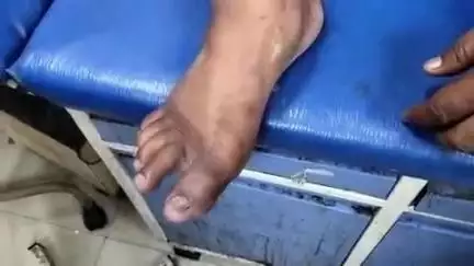 सासनी: गांव कुंडा में मंदिर में पूजा करने जा रहे एक व्यक्ति को सांप ने काटा, परिजन लेकर पहुंचे अस्पताल
