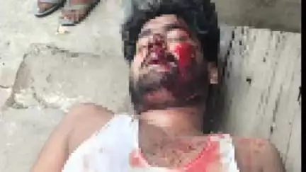 हरनौत: गंगा मेमोरियल पॉलिटेक्निक कॉलेज के पास NH-20 किनारे जख्मी युवक मिला, चेरो ओपी पुलिस ने अस्पताल भेजा