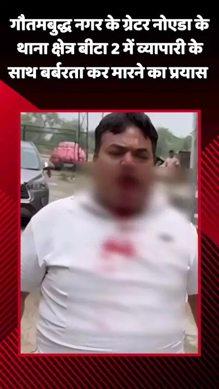 गौतम बुद्ध नगर: गौतमबुद्ध नगर के ग्रेटर नोएडा में थाना क्षेत्र बीटा 2 में व्यापारी के साथ बर्बरता कर मारने का प्रयास