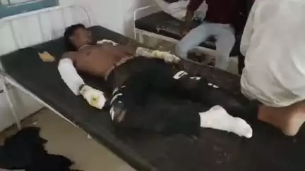 नरसिंहपुर: परतापुर के पास फोर व्हीलर ने बाइक को टक्कर मारी, बाइक चालक गंभीर रूप से घायल