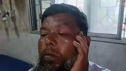 ক্যানিং ১: ক্যানিংয়ের পরানিখেকো গ্রামে টাকা নিয়ে ঝামেলার জেরে প্রতিবেশীদের হাতে আক্রান্ত ব্যক্তি, থানায় অভিযোগ দায়ের