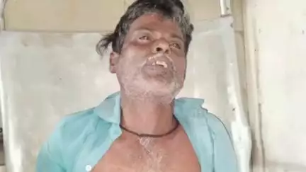 जैसीनगर: सांप काटने से व्यक्ति की मौत, जैसी नगर थाना क्षेत्र के वांसा गांव की घटना