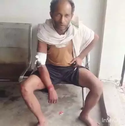 अनूपपुर: खाड़ा में अधेड़ के साथ मारपीट, घायल ज़िला अस्पताल में भर्ती