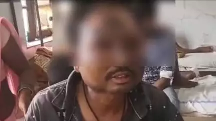सिवनी: जामुनटोला गांव में पेट्रोल पंप पर काम करते समय हाईटेंशन लाइन की चपेट में आने से युवक घायल