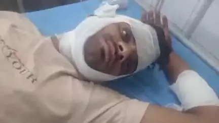मांगरौल: हिंगोनिया गांव निवासी युवक के साथ अज्ञात लोगों ने बारां मंडी रोड पर की मारपीट, घायल को जिला अस्पताल में कराया भर्ती