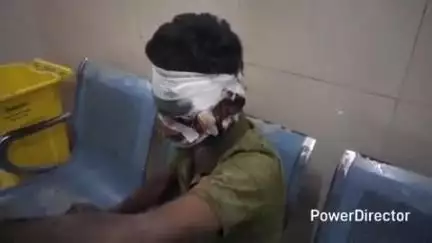 कटिहार: मनिया में बाइक सवार अनियंत्रित होकर गिरा, हुआ जख्मी, अस्पताल में भर्ती