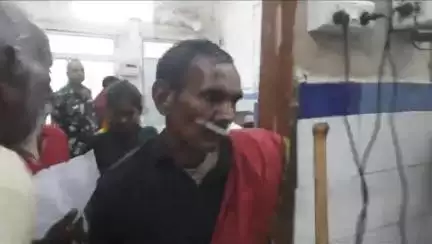 औरंगाबाद: भदवाडीह, आशा बिगहा, भदवा बाजार एवं हरिहरगंज के 20 लोगों को पागल कुत्ते ने काटा, सदर एवं निजी अस्पतालों में हुआ इलाज