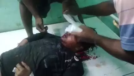 রানিনগর ২: কলবলিতলা গ্রামে মোটরসাইকেল এর নিয়ন্ত্রণ হারিয়ে গুরুতর আহত ১ অবস্থার অবনতি ঘটলে স্থানান্তর MMC হাসপাতালে