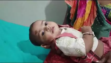 आबापुरा: डाबड़ी माल गांव में पिकअप ने बाइक को चपेट में लिया, मां-बेटी को लगी चोट, एमजी अस्पताल में उपचार जारी