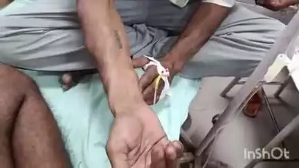 कायमगंज: गर्मी का मौसम आते ही भट्टी में छुपे सांप निकलने लगे, गांव नवादा के युवक को हाथ में सांप ने डसा, हालत बिगड़ी
