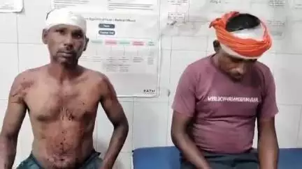 मुरादाबाद: कटघर थाना क्षेत्र में ₹5000 के लेनदेन को लेकर मां-बेटे ने मिलकर दो सगे भाइयों के साथ की मारपीट