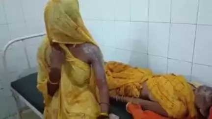 टीकमगढ़: कारी गांव में कुकर फटने से सास-बहू झुलसीं, ज़िला अस्पताल में भर्ती