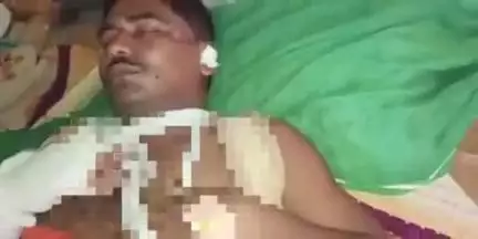 चिनिया: बेता गांव में भीषण सड़क हादसे में झामुमो पंचायत अध्यक्ष संजय यादव घायल, गढ़वा के लिए रेफर किया गया