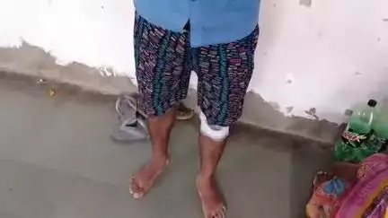 सीतापुर: बनिगवां ग्राम पंचायत में नाली के पानी को लेकर हुई कहा-सुनी में जमकर मारपीट, दोनों पक्ष के 2 लोग घायल