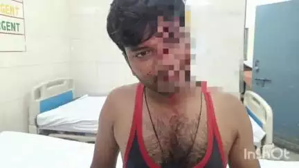 बरेली: सीबीगंज थाना क्षेत्र के महेशपुर के रहने वाले युवक को उसके बड़े भाई ने पीटकर किया घायल, पुलिस से की शिकायत