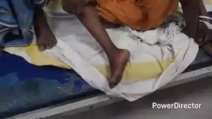 कटिहार: केवटिया में घर में काम करते समय महिला को जहरीले सांप ने काटा, अस्पताल में भर्ती