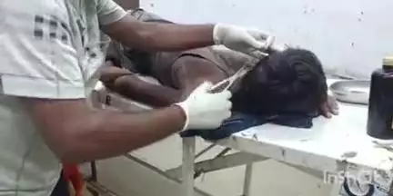 खुसरूपुर: रेलवे यार्ड मार्ग पर अनियंत्रित बाइक ने किशोर को मारी टक्कर, किशोर घायल