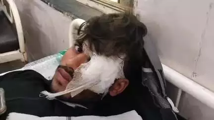 भिंड नगर: सोई गाँव रोड पर अज्ञात वाहन की टक्कर से बाइक सवार युवक हुआ घायल