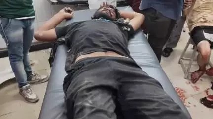 पाली: राईको की ढाणी में दो पक्ष हुए आमने-सामने, एक पक्ष के 2 लोग हुए घायल