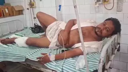 पीरपैंती: पीरपैंती में जमीनी विवाद में बगीचे में चली गोली, युवक घायल