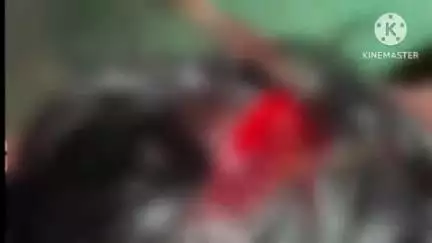 प्रतापगढ़: नगर पंचायत सुवांसा निवासी युवक पर पुरानी रंजिश के चलते जानलेवा हमला