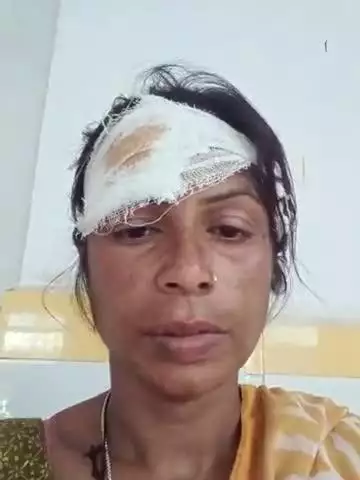 यह घटना भंडार रोड की है अटल बिहारीकॉलोनी के प