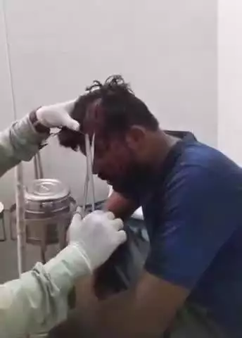 तालबेहट: चौबयाना निवासी युवक के साथ दबंगों ने लाठी, डंडा और लात-घूसों से की मारपीट, सिर में आई गंभीर चोट, 3 पर मामला दर्ज