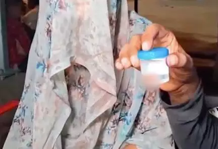 यूपी के हरदोई में व्यक्ति ने प्रेमी से मिलने गई अपनी पत्नी की काटी नाक, महिला गंभीर रूप से हुई घायल