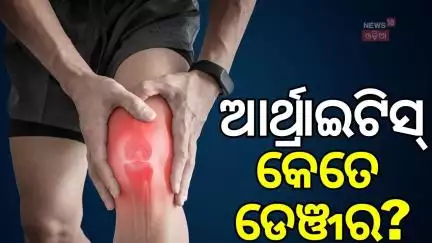 କଣ ଏହି ଆର୍ଥ୍ରାଇଟିସ୍ What is Arthritis: Naveen Patnaik Health | Naveen Mumbai Visit | Odia News