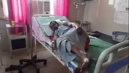 अमरोहा: मुरादाबादी गेट इलाके में चार्जिंग के दौरान बैटरी फटने से घर में लगी भीषण आग, तीन लोग झुलसे अस्पताल में भर्ती