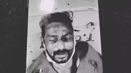 शिवपुरी नगर: बैराड में सड़क पर घायल मिला 45 वर्षीय व्यक्ति, अस्पताल में भर्ती कराया, डॉक्टर ने किया मृत घोषित