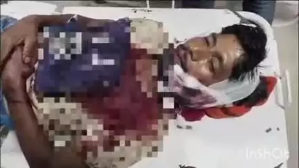 बड़हरा: काजीचक गांव में ताड़ी विवाद को लेकर एक व्यक्ति को फसुली मारकर किया घायल, बड़हरा पीएचसी से आरा सदर अस्पताल रेफर