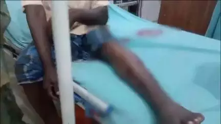 ചാവക്കാട്: തെക്കൻ പാലയൂരിൽ രണ്ടിടത്ത് വീണ്ടും കുറുനരിയുടെ ആക്രമണം, മൂന്നു പേർക്ക് കടിയേറ്റു