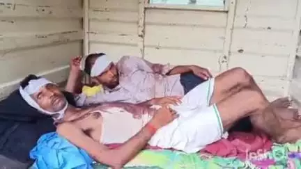 दरवापुर में हैंडपंप पर पानी भर रही बेटी को गाली देने का विरोध करने पर दबंग विपक्षियों ने पीड़ित परिवार को पीटा