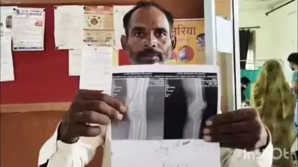 मैनपुरी: जिला अस्पताल में मरीजों को एक्सरे के बाद कागज पर प्रिंट करके दी जा रही एक्सरे रिपोर्ट, मरीज हुए परेशान #jansamasya