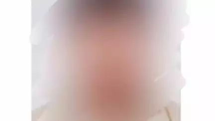 ಬೆಳ್ತಂಗಡಿ: ಪರ್ಕಳ ಸೇತುವೆ ಬಳಿ ನಡೆದ ರಸ್ತೆ ಅಪಘಾತದಲ್ಲಿ ಗಾಯಗೊಂಡಿದ್ದ ಯುವಕ ಸಾವು