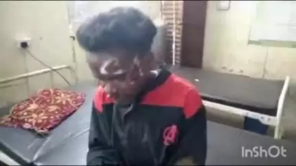 बालूमाथ: दिरीदाग गांव के पास बाइक दुर्घटना में ससुराल जा रहा युवक घायल