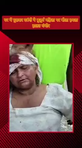 मेरठ: लोहिया नगर क्षेत्र में मामूली कहासुनी के बाद दबंगों ने बुजुर्ग महिला पर हमला किया, ईट से सिर फोड़कर हालत गंभीर